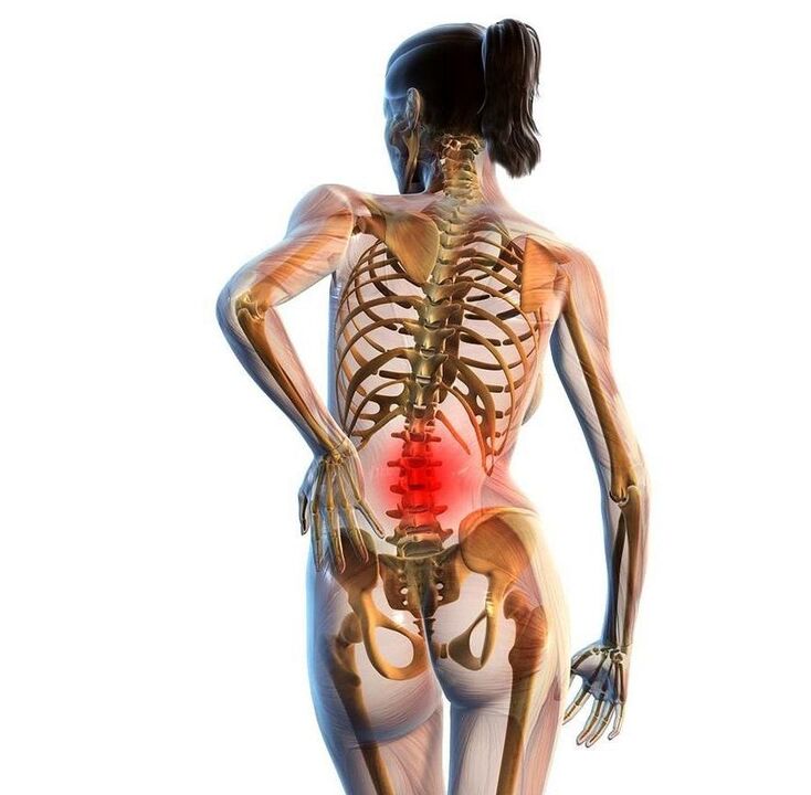 Dolor lumbar