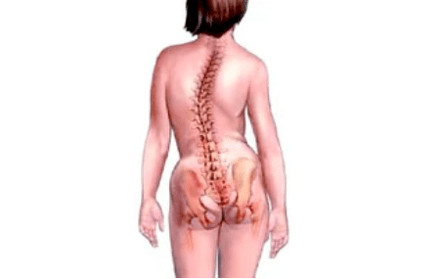 Razones para el desarrollo de la osteocondrosis cervical.