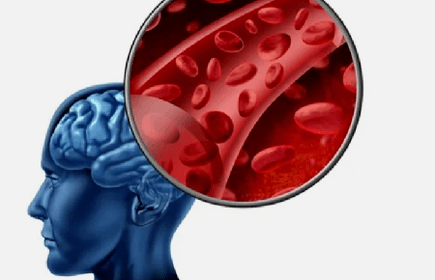 síntomas de osteocondrosis de la columna cervical