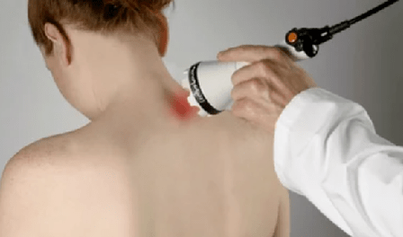 tratamiento de la osteocondrosis cervical mediante métodos de fisioterapia