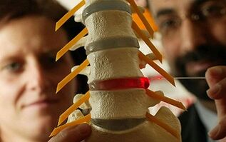 Síntomas y tratamiento de la osteocondrosis de la columna torácica