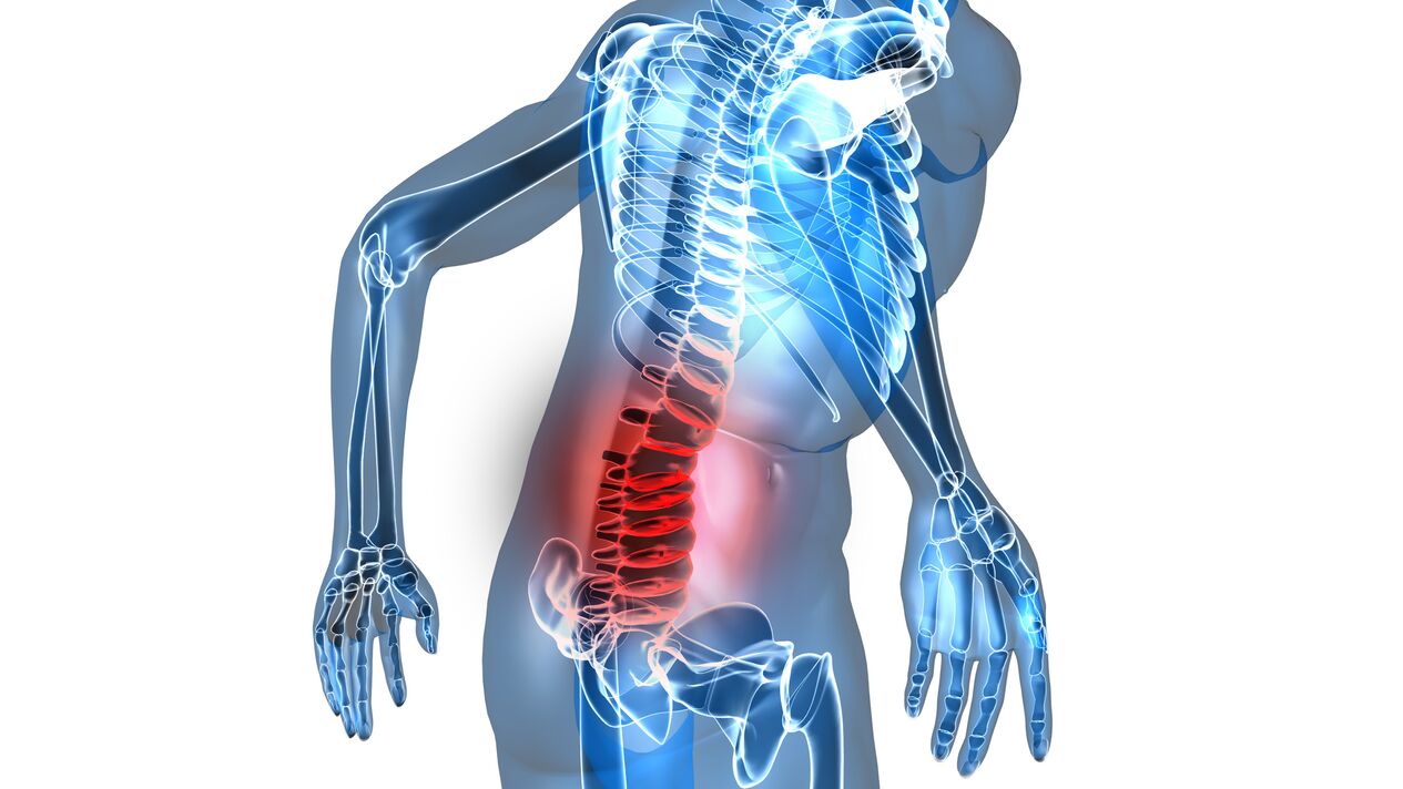 osteocondrosis de la columna lumbar